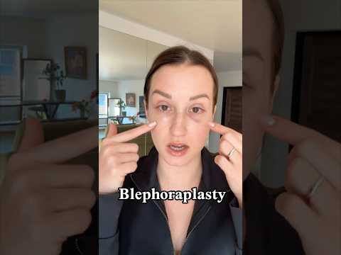التجميل في بيلاروسيا #جفون #عملية_التجميل