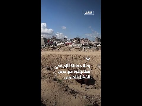 رحلة معاناة نازح في قطاع غزة مع مرض الفشل الكلوي