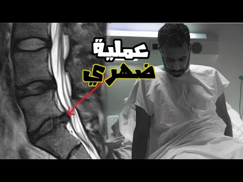 عملية ضهري | فضائح التأمين الصحي في أستراليا Medicare