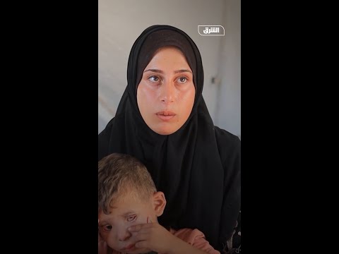 اتفاق غزة يمنح أملاً لأطفال القطاع المصابين