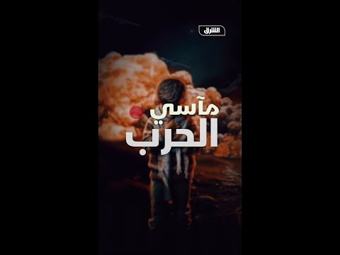 اتفاق غزة يمنح أملاً لأطفال القطاع المصابين