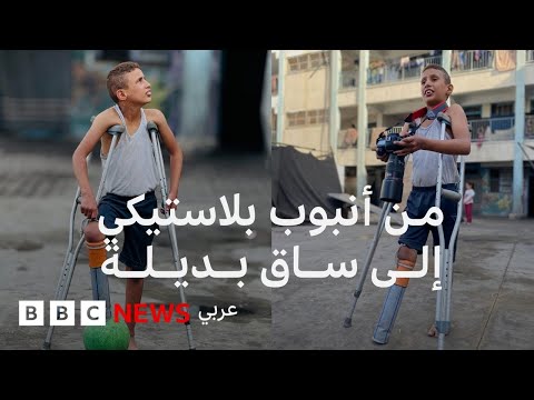 قصة طفل غزي فقد ساقه في غارة إسرائيلية