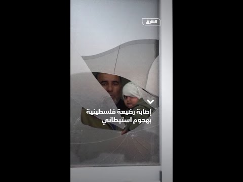 إصابة رضيعة فلسطينية بهجوم استيطاني